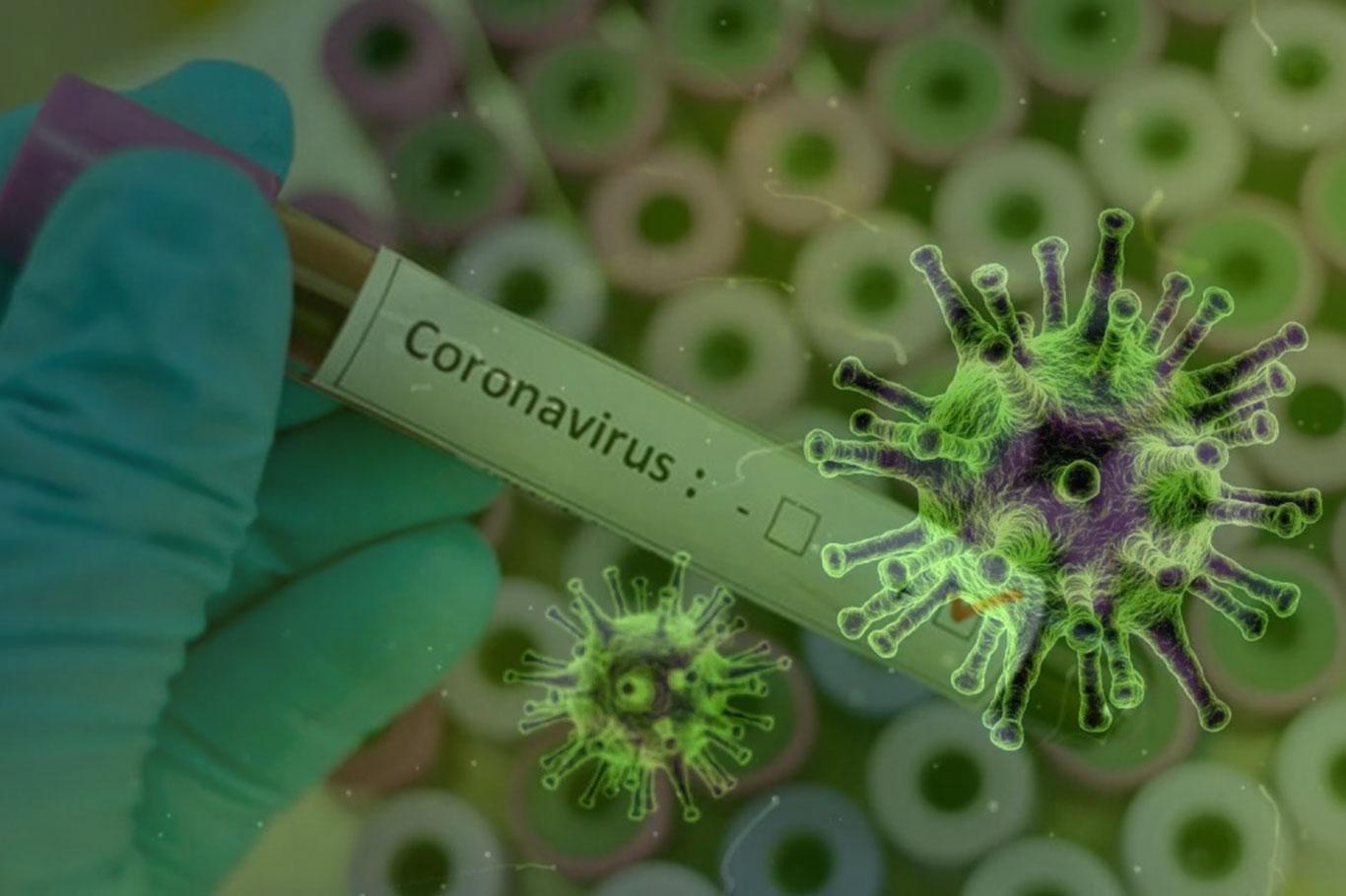 Dünya geneli Coronavirus vaka sayısı 20 milyon 800 bini geçti